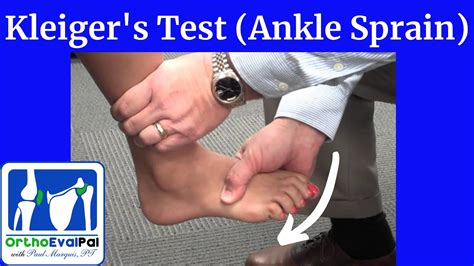 kleiger's test ankle